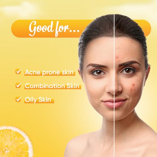 Ozone Acne Check Face Wash | Enriched with Aloe Vera, Lemon & Turmeric | For Oily Skin, Pimples, Acne Prone, Flawless & Glowing Skin | For Men & Women | 100gm from Ozone