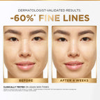 L'Oreal Paris Revitalift Serum, Hydrating and Plumping, With 1.5% Hyaluronic Acid, 15ml  from L’Oréal Paris
