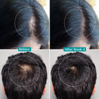 Pilgrim Redensyl 3% + Anagain 4% + Baicapil Advanced Hair Growth Serum (30ml) for Scalp with Korean Black Rice, Saw Palmetto | Control Fall, Stimulate Regrowth, Increase Density | For Women & Men