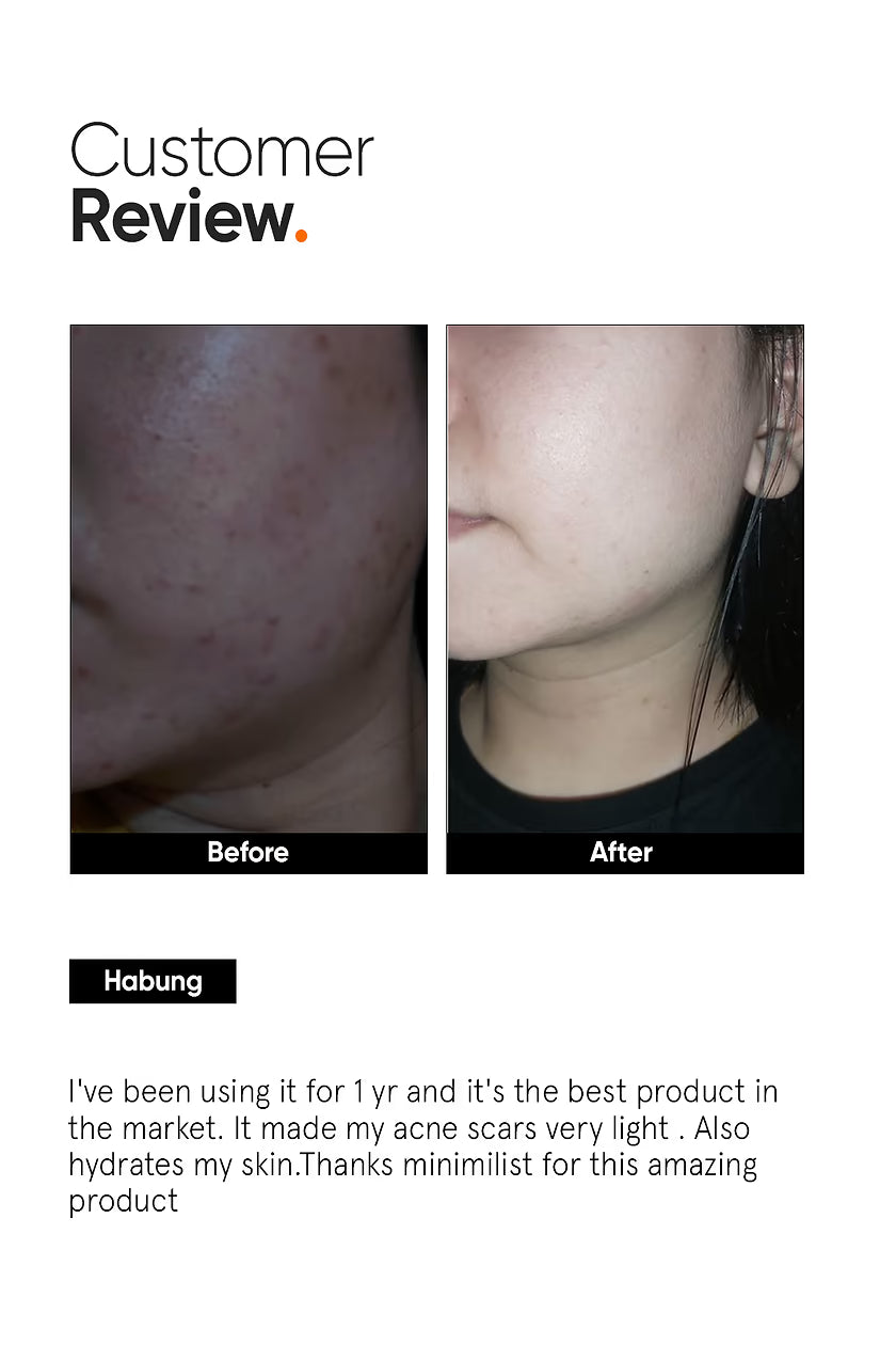 Minimalist Dark Spots Removal Serum with 2% Alpha Arbutin for Hyperpigmentation | Face Serum for Blemishes, Acne Marks & Tanning with Hyaluronic Acid & Butylresorcinol | For Women & Men | 30 ml