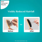 Pilgrim RootActive™ Anti-Hairfall Serum With Spanish Rosemary - 30 ml